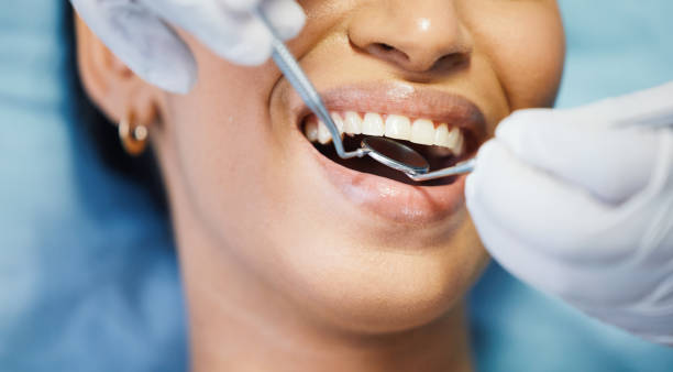Best Emergency Treatment for Oral Infections in Denton, TX